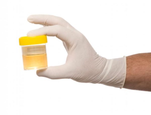 Перед тем как провести УЗИ, для лучшего наполнения пузыря, пациенту нужно выпить большое количество жидкости