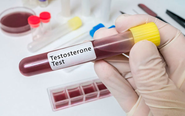 К сдаче анализа крови на тестостерон необходимо подготовиться
