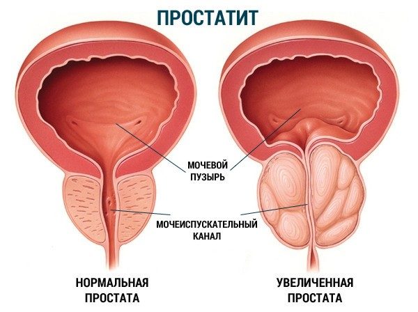Изменения размера или структуры железы указывает на развитие патологии