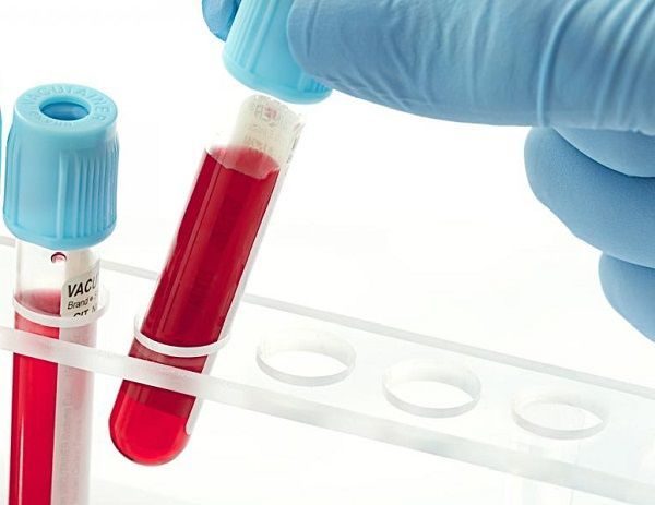 Анализы крови на гормоны фсг пролактин thumbnail