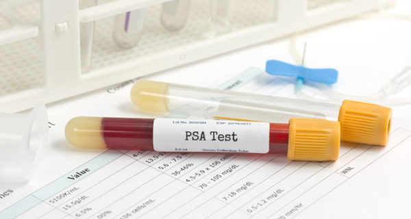 В результатах анализа также важно отметить уровень ПСА в крови
