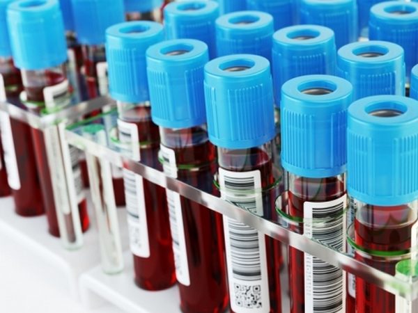 Анализ крови на ПСА нужно сдавать регулярно в ходе планового медосмотра