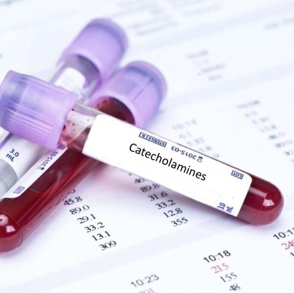 Анализ крови на катехоламины