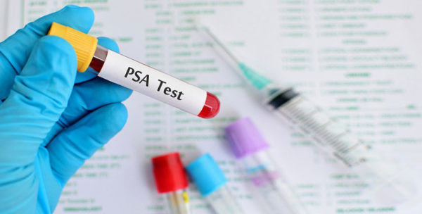 Анализ крови на ПСА необходим для определения того, есть ли в организме пациента злокачественные опухоли