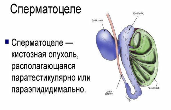 Гормональный живот у мужчин фото